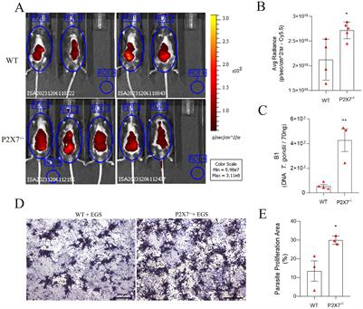 Inflammatory response and parasite regulation in acute toxoplasmosis: the role of P2X7 receptor in controlling virulent atypical genotype strain of Toxoplasma gondii